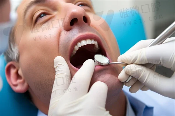 牙齿窝沟封闭的操作流程