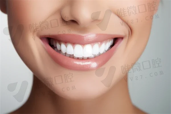 惠州致美口腔医院与惠阳优品口腔门诊部,哪家更值得选择?深入对比揭晓答案!