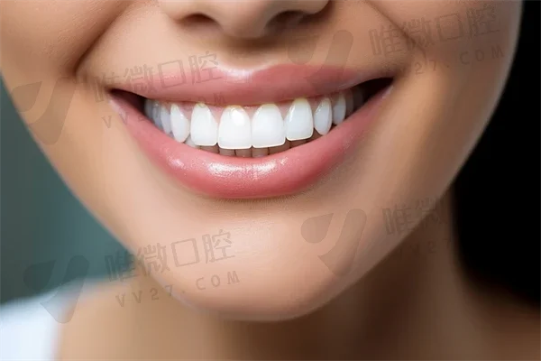 ：杭州牙科医院滨江院区龅牙整形技术领先