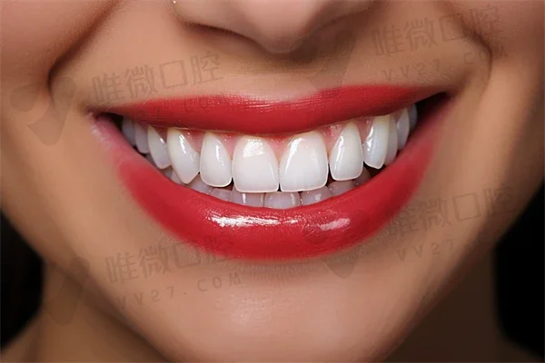 兰州博邦齿科诊所牙齿整形是技术派荣获榜首