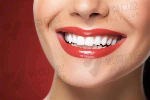 杭州牙齿美白医院排名榜非常新发布：薇琳口腔入选前三