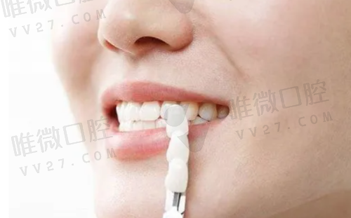 TOP3 咸阳诺贝尔口腔