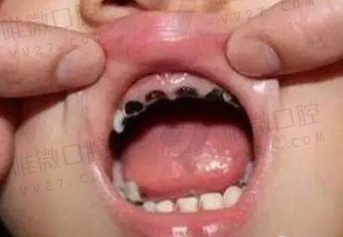 别光看价格,达美在服务态度和收费透明度上也没拉垮!