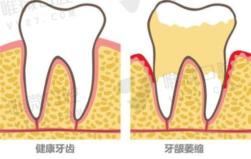 2025重庆医科大学附属口腔医院价目表:种植牙4312+牙齿矫正35000+冷光美白419+