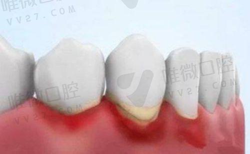 张家界湘茜口腔医院靠谱吗?与湖南湘西口腔医院对比,为你揭秘口腔医疗真相!