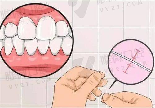 北京劲松口腔医院洗牙、补牙项目小而精,价格超良心