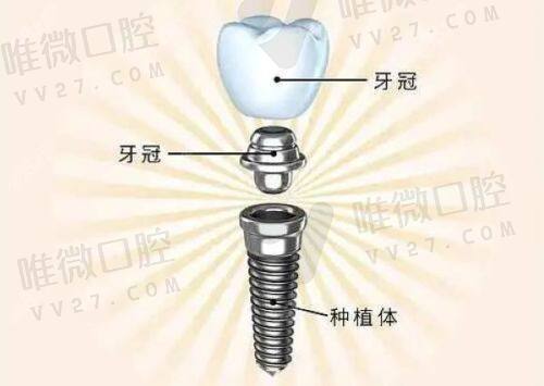 深圳洁芽口腔诊所怎么样？其收费标准与知乎评价值得深入探究！ 