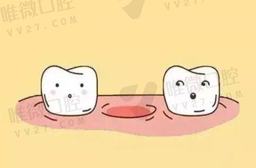 北京劲松口腔医院根管治疗价格区别:前牙后牙要花不一样的钱