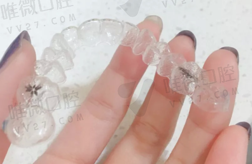 宜昌中汉口腔种植牙价格表2025：登腾1480+百康特2680+安卓健5800+诺贝尔7800+