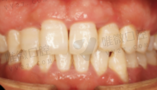 北京牙元素口腔种植医生有哪些?技术水平靠谱吗?