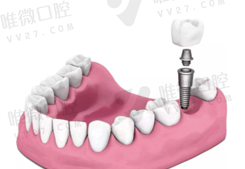 淮安牙知道口腔拔牙费用直降：普通拔牙99元起，智齿再复杂也有良心价