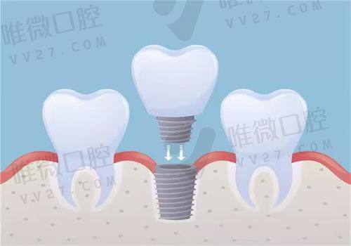 儿童齿科价格一览，亲民又科学