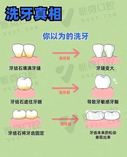 智齿难拔？轻松对价不挨“坑”