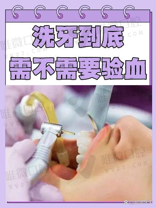 洗牙项目价格清晰又透明，还带洁牙风格？