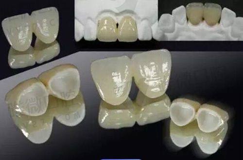 设备数码化，种牙结果更像“天生的”