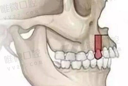2. 广州柏德口腔