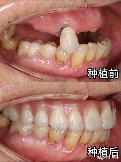 成都布莱梅联合口腔：设备新全，个性化方案丰富