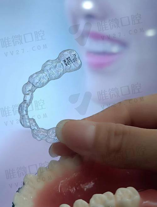 2025中诺口腔医院价格表大揭秘:种植牙2980+牙齿矫正8000+假牙2000+根管治疗2000+