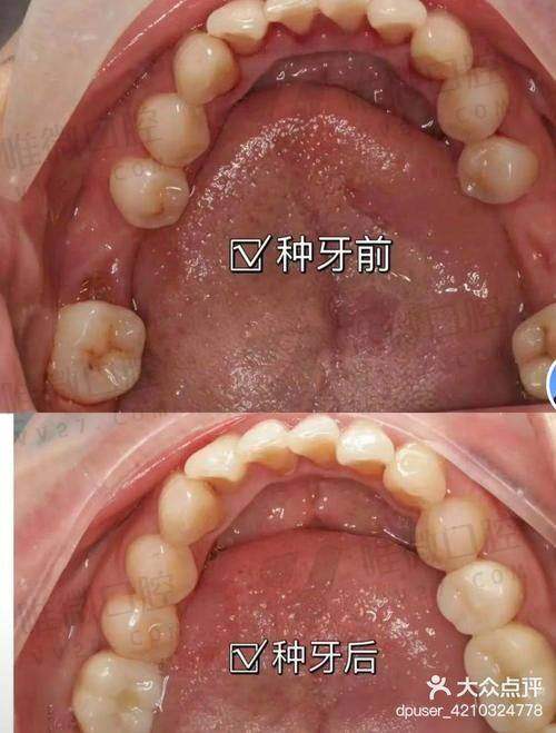 厦门麦芽口腔医院的热门项目哪几个更受好评？