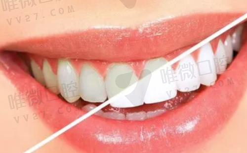 云南普洱九洲医院口腔科是公立还是私立?偷偷告诉你收费标准天上掉馅饼!