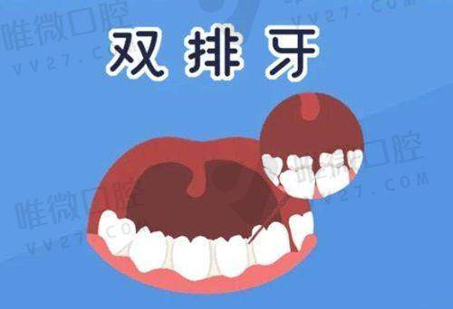 泰康拜博口腔收费标准2025，种植牙3000+牙齿矫正6000+补牙100+洗牙60+