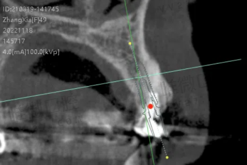 定靖口腔医院：售后和患者体验做得怎样？