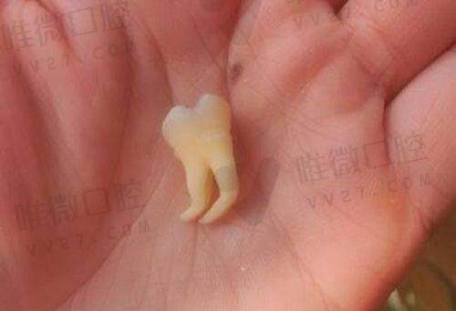 现场预约