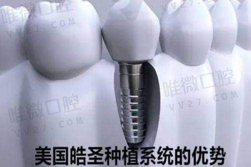 西安团圆口腔医院靠谱吗？是正规的连锁医院看牙很靠谱