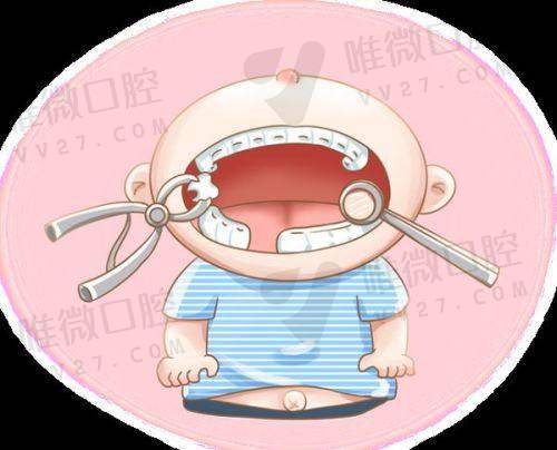 成都团圆口腔真实种牙反馈:实例多,修复快,看着就跟真牙一样