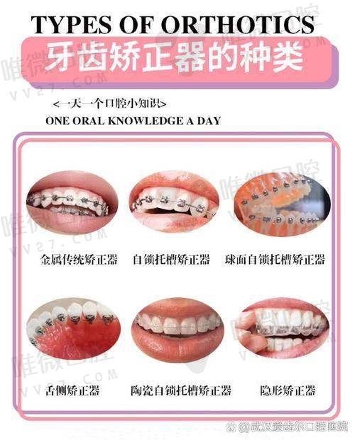 体验细节：这些贴心的“小动作”打动人心