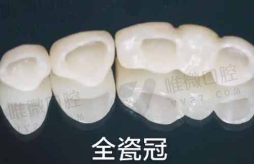 成都西南口腔医院是私立还是公立？是私立的 但医院资质齐全有常驻医生可以放心