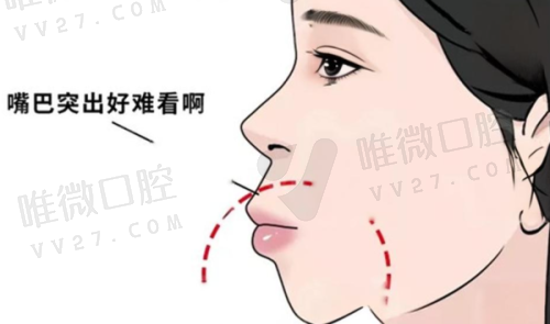 3. 汕头柏恩口腔