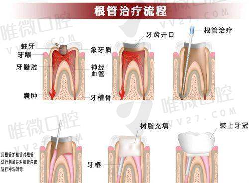 四、选择医院看牙的小建议