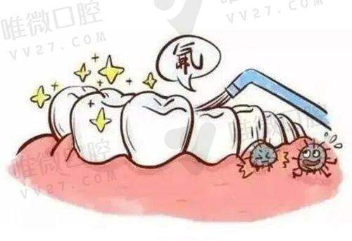 杭州艺星口腔收费贵不贵?价格表公开透明,无隐形消费