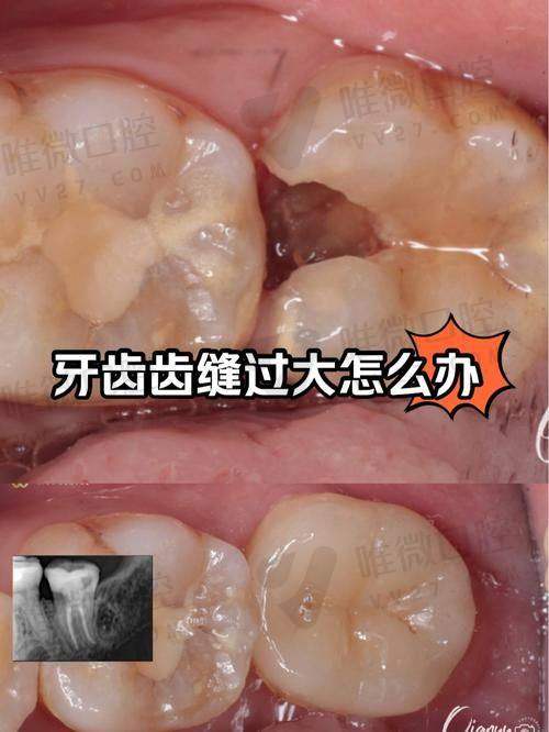 1. 广州穗华口腔门诊医院