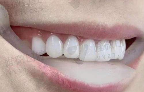 武汉大学口腔医院急诊中 心(24小时不限时段)