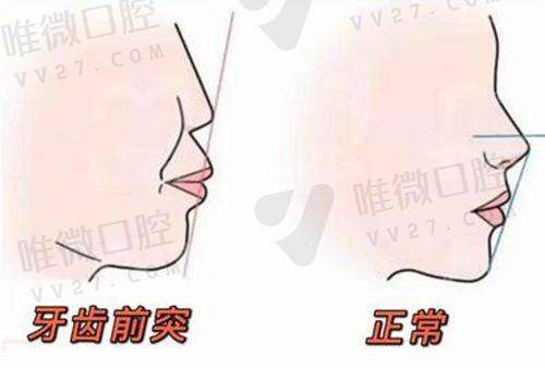 项目特色