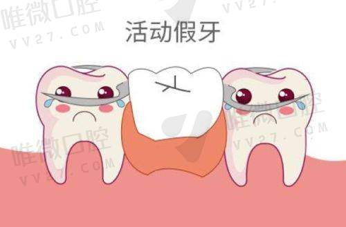 北京中诺口腔价格怎么样？种牙贵不贵？