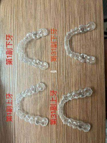 海宁市人民医院口腔科——牙齿美白价格明细
