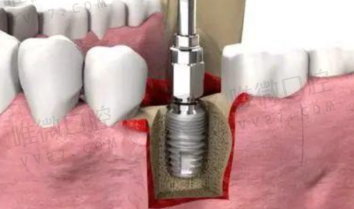 延吉韩世口腔医院都提供哪些牙科项目？价格怎么样？