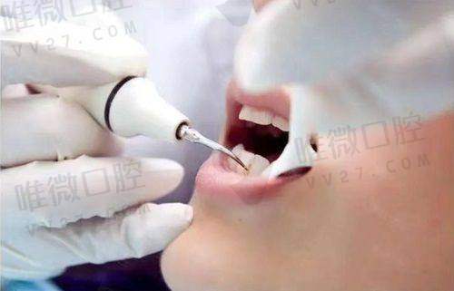 上海舜川口腔门诊部怎么样?是正规的吗靠谱不今天一文来解答
