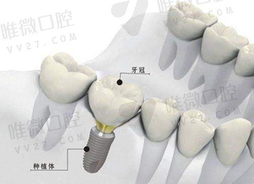 看似“贵”，实则值？从医疗团队水平解读价格价值