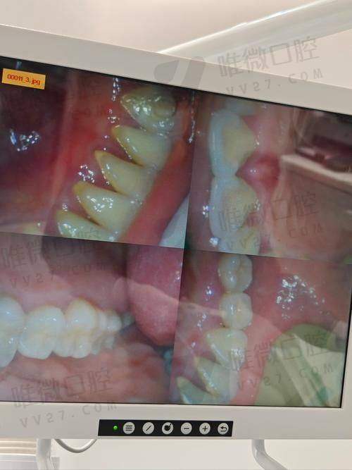 深圳千喜口腔医院怎么样？是值得信任的性价比高之选很靠谱