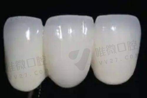 北海市人民医院口腔科种植牙包含什么项目?透明细致不花冤枉钱