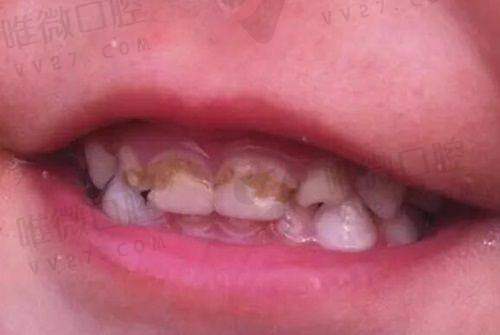 医疗保险报销问题 + 是否值得体验?