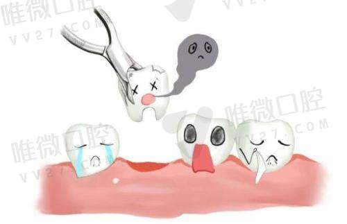 在广州口碑和影响力双优，种牙患者反馈一致好评