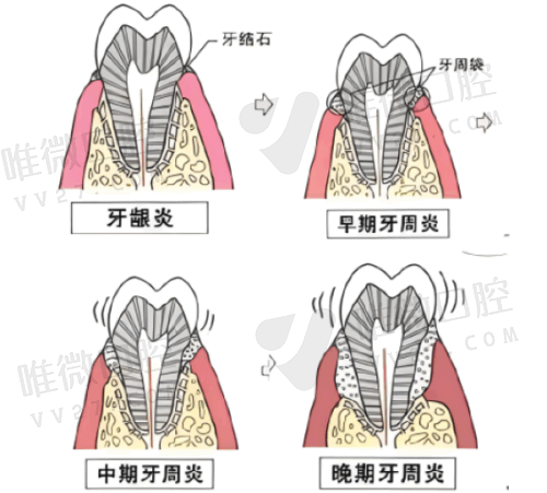苏州华夏口腔医院其余检查及常规费用