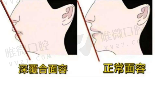 广州曙光口腔是靠技术吃饭的：种牙、矫正两手抓，实力撑起口碑