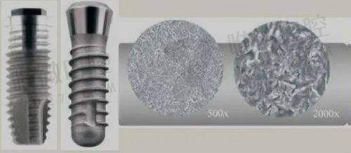 济宁壹颗芽口腔特色技术：数字化水平高，种牙矫正齐升级