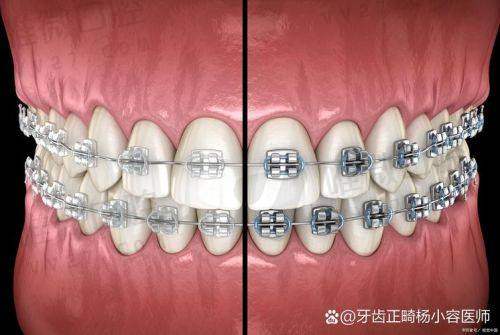 二、9000元能拿下？小心这些“价格刺客”